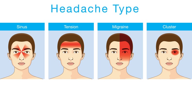 Dit zijn de meest voorkomende soorten hoofdpijn