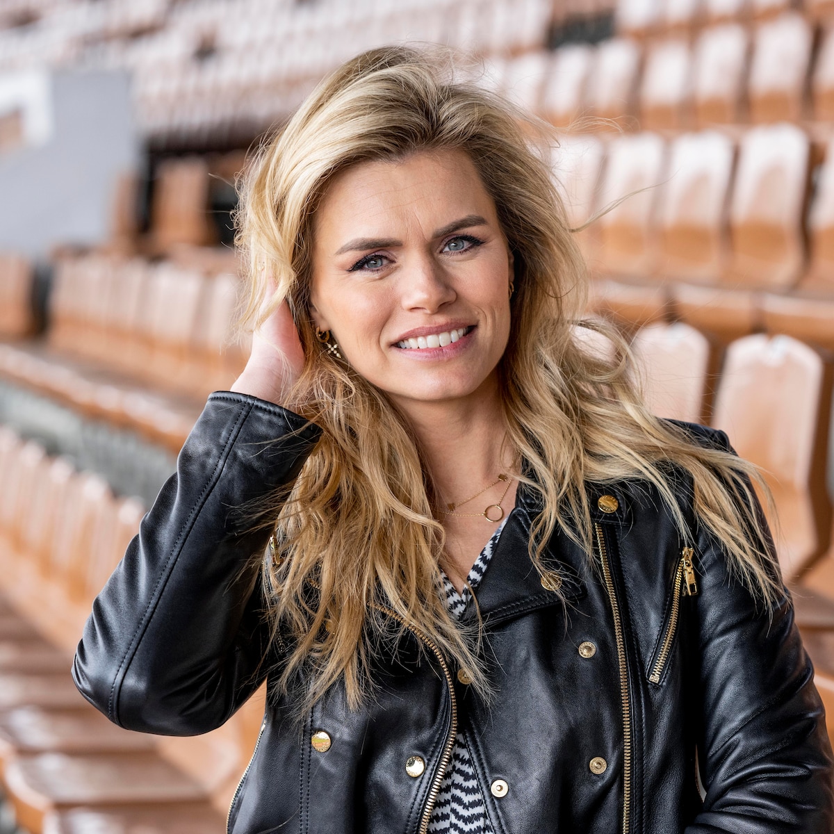 Nicolette van Dam openhartig over huidaandoening vitiligo Libelle